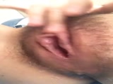 逼好痒怎么办